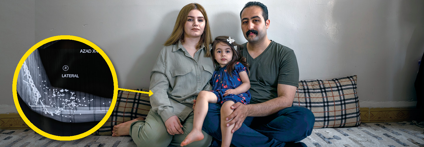 Photo of an Iranian family of three with an X-ray image of the mother&apos;s arm